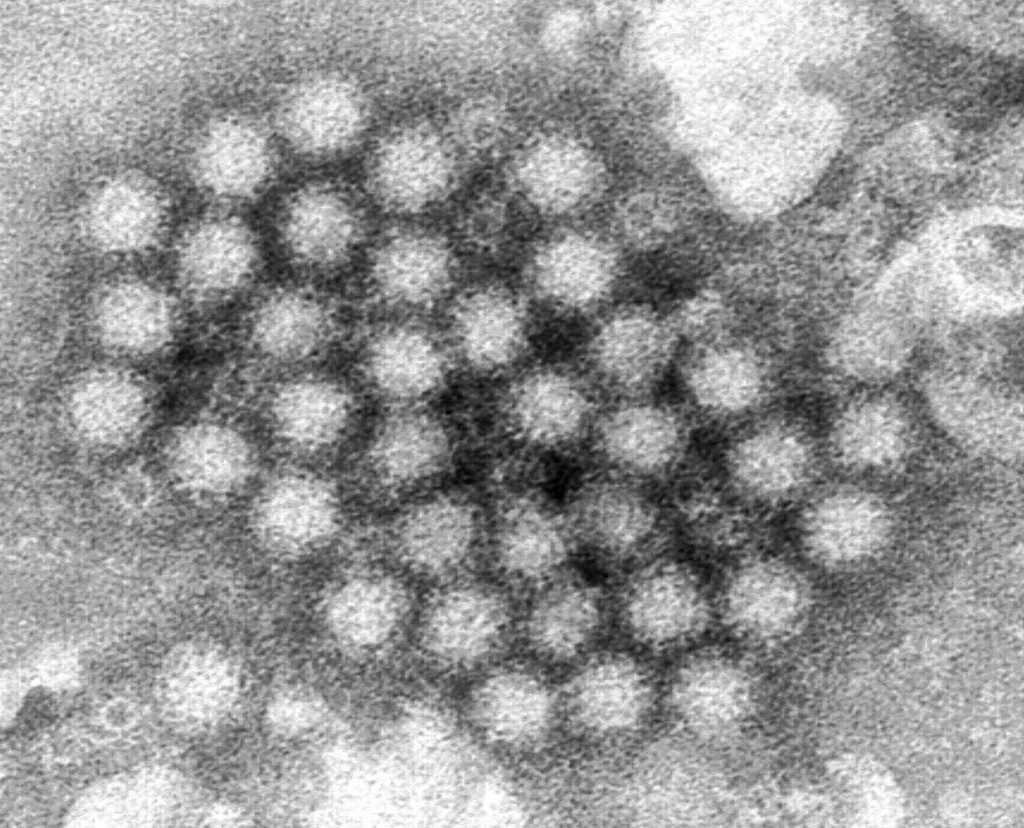 CDC: Casos de norovírus aumentam em partes dos EUA neste inverno